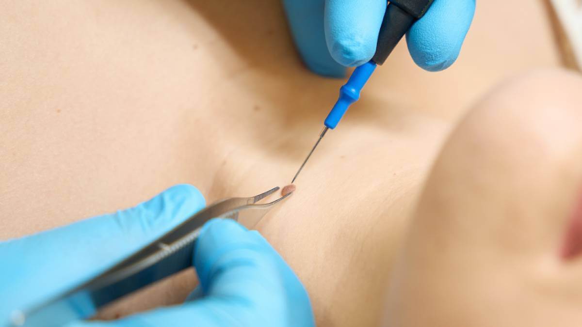 laying down whilst being injected