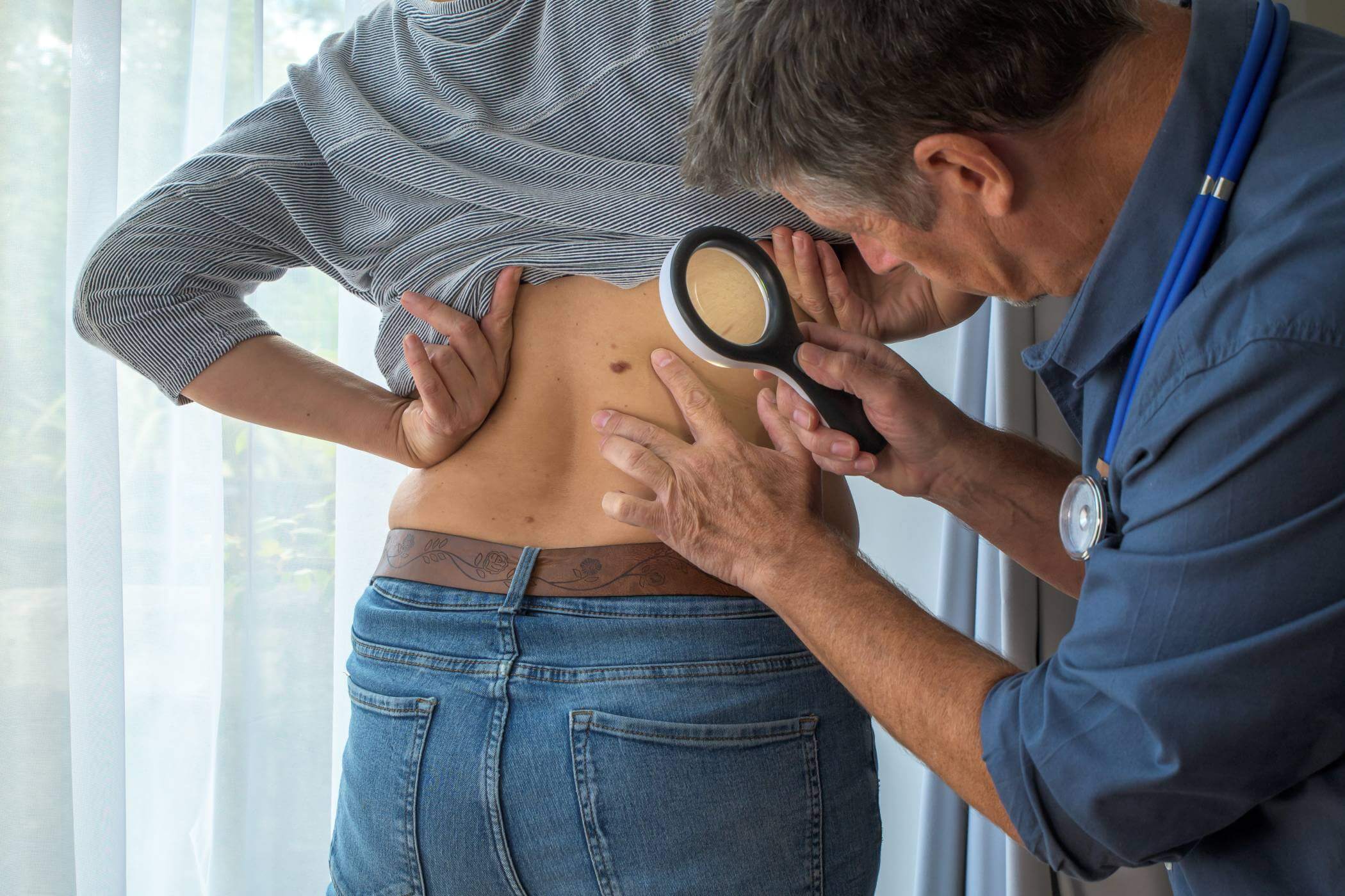 Doctor checking mole